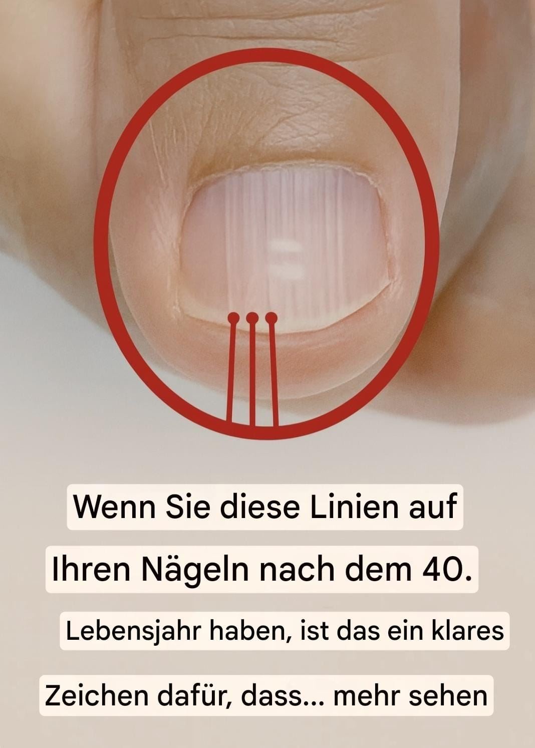 Wenn nach 40 Jahren Falten auf Ihren Nägeln erscheinen, könnte dies ein Warnzeichen sein…