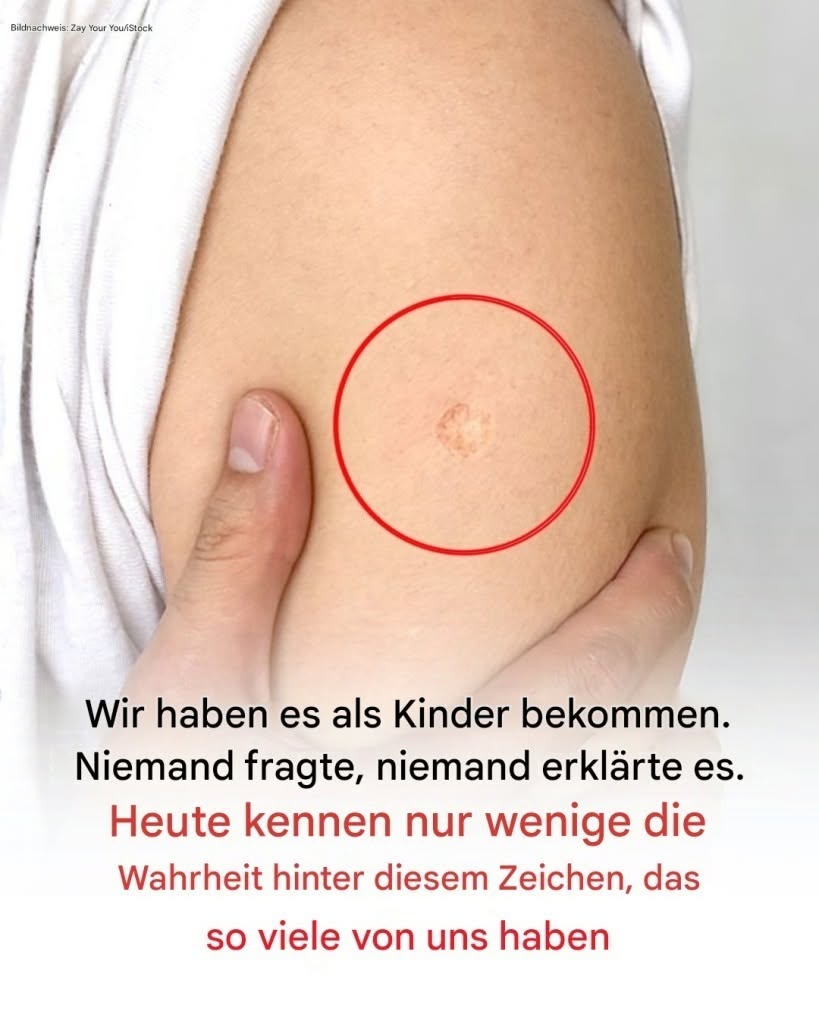 Die Wahrheit hinter der mysteriösen runden Narbe am Oberarm