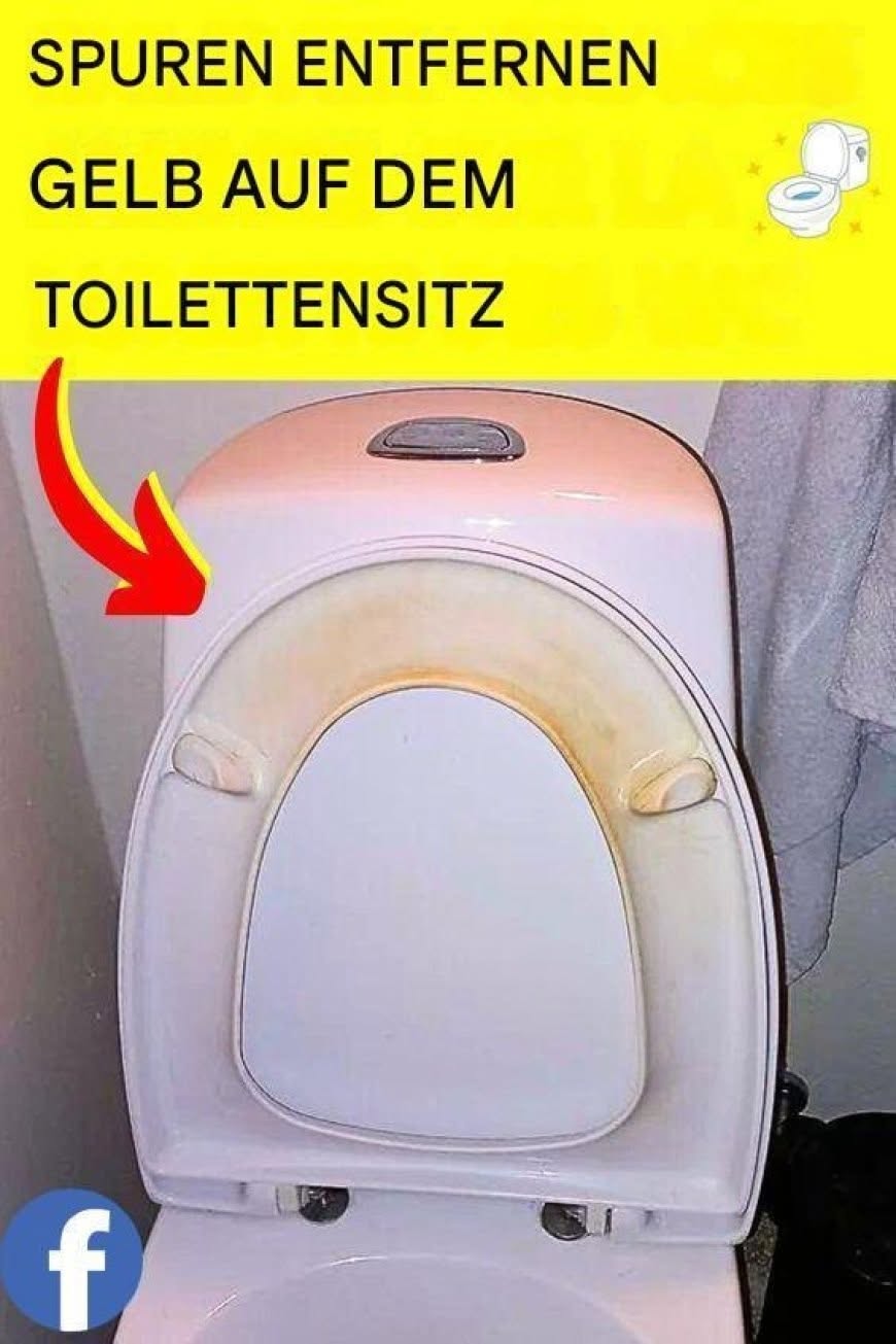 Der Trick, um gelbe Flecken auf dem WC-Sitz zu entfernen