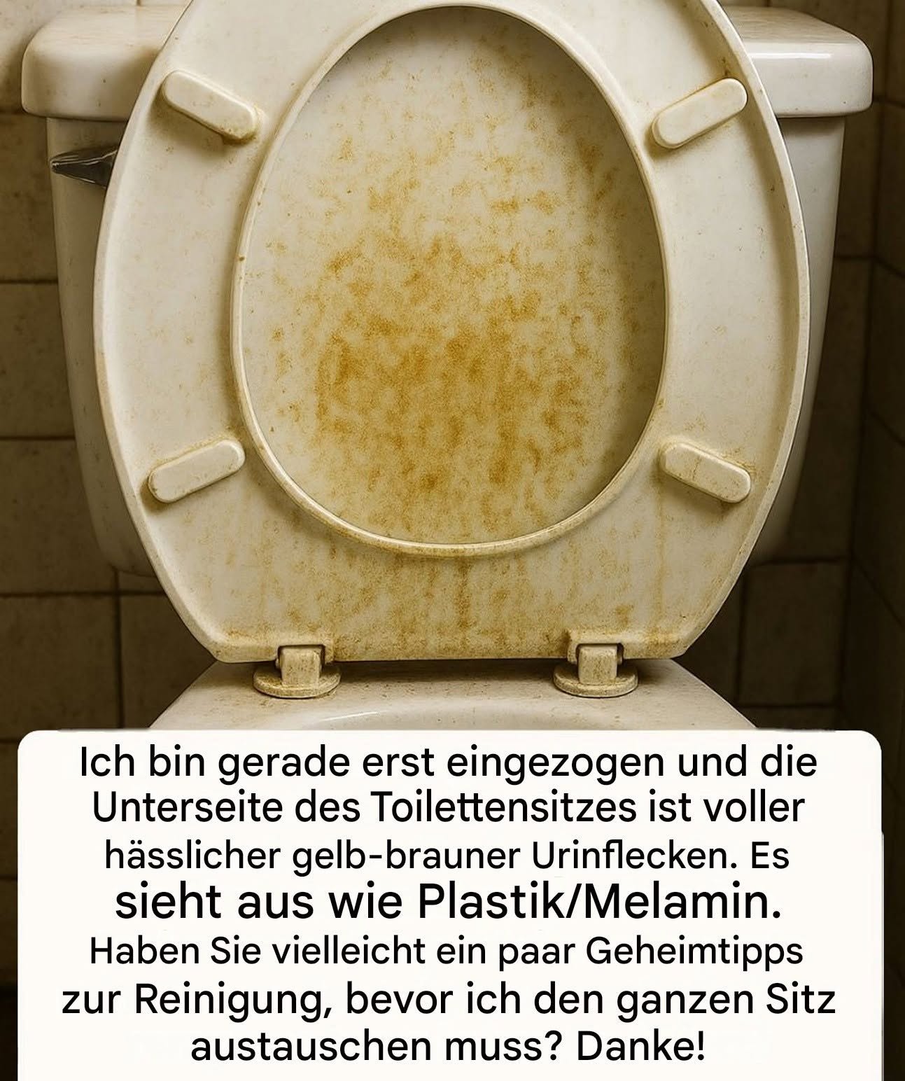 Wie reinige ich den Toilettensitz?