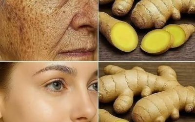 Ingwer ist 100-mal wirksamer als Botox bei der Beseitigung tiefer Falten, Sommersprossen und Pigmentflecken. Ich muss das einfach loswerden, damit ihr weiterhin meine Rezepte erhaltet… Danke! Rezept im Kommentar