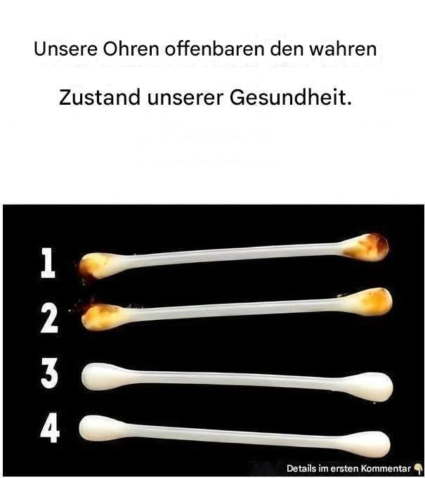Unsere Ohren offenbaren den wahren Zustand unserer Gesundheit.