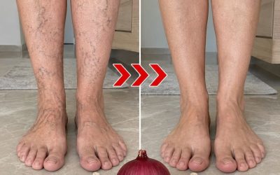 Voici la traduction exacte et naturelle de cette phrase en allemand :  “Das natürliche Heilmittel, das Krampfadern reduziert und die Durchblutung in wenigen Wochen verbessert