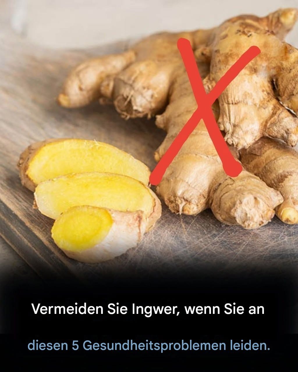 Vermeiden Sie Ingwer, wenn Sie diese 5 Gesundheitsprobleme haben.