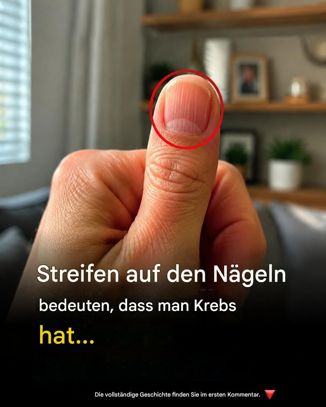 Linien auf Ihren Fingernägeln: Was sie über Ihre Gesundheit verraten könnten