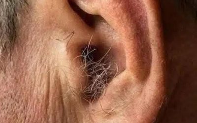 WUSSTEN SIE SCHON? Wenn Ihnen Haare an den Ohren wachsen, liegt das daran, dass Ihr Körper…