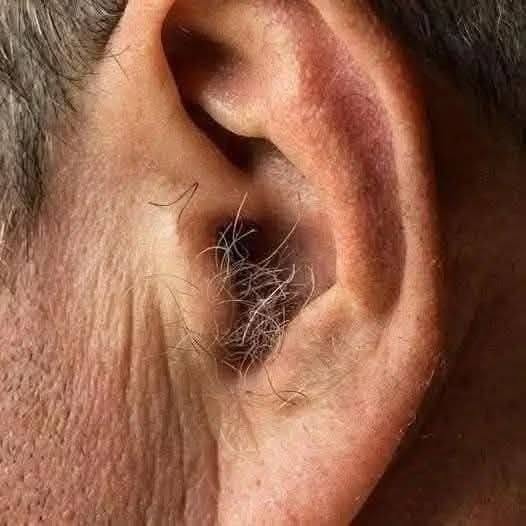 WUSSTEN SIE SCHON? Wenn Ihnen Haare an den Ohren wachsen, liegt das daran, dass Ihr Körper…