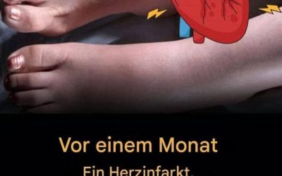 Einen Monat vor einem Herzinfarkt warnen Sie Ihre Füße vor diesen 6 Anzeichen