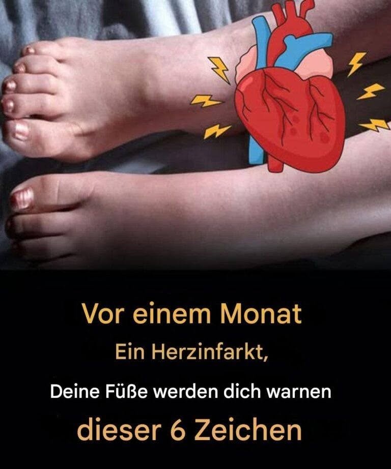 Einen Monat vor einem Herzinfarkt warnen Sie Ihre Füße vor diesen 6 Anzeichen