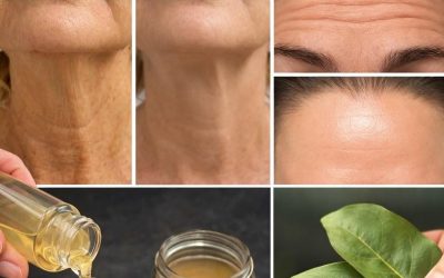 Warum Lorbeerblätter ein natürliches Mittel gegen Falten sind – 100.000 Mal wirksamer als Botox!