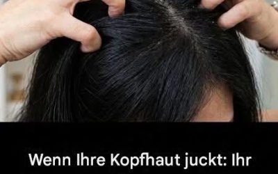 Juckt Ihre Kopfhaut? Wir erklären Ihnen die Ursachen des Problems.