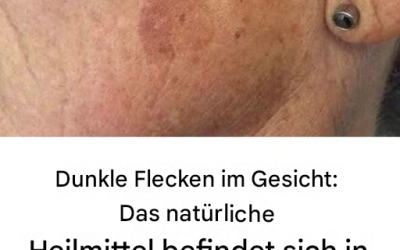 Mischen Sie es in Ihre Creme und Hautunreinheiten im Gesicht gehören der Vergangenheit an.