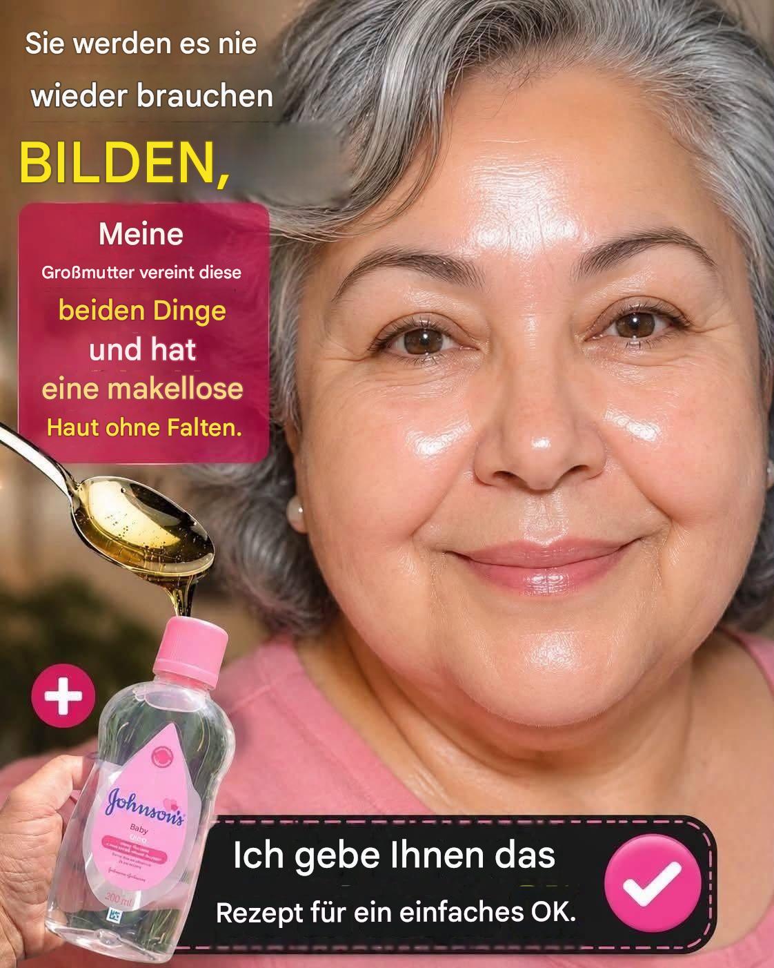 So sahen meine Hände 15 Tage vor der Anwendung dieses Hausmittels aus.