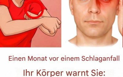 Einen Monat vor einem Schlaganfall warnt Sie Ihr Körper: 10 Anzeichen, die Sie nicht ignorieren sollten