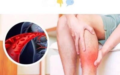 Ein Vitamin, das die Blutgefäße erweitert und die Durchblutung verbessert
