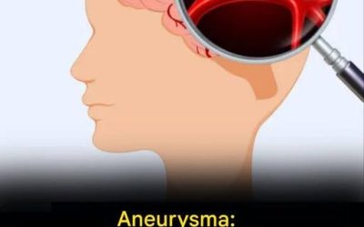 10 Anzeichen, um verstopfte Arterien zu erkennen