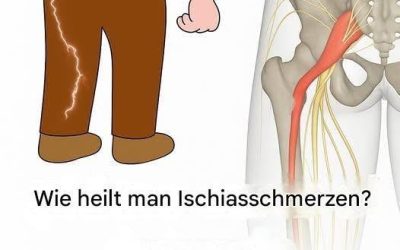 3 Übungen zur Linderung von Ischiasschmerzen im Bein: Praktisch und effektiv