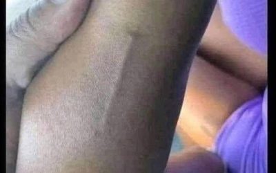 Ich habe das am Arm meiner Tochter gefunden und versuche immer noch herauszufinden, was es ist.