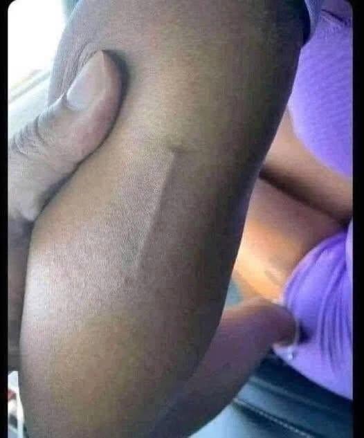 Ich habe das am Arm meiner Tochter gefunden und versuche immer noch herauszufinden, was es ist.