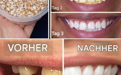 Eierschalen verwandeln gelbe Zähne in perlweiß in nur 5 Minuten*😱 Mehr dazu im ersten Kommentar⤵️