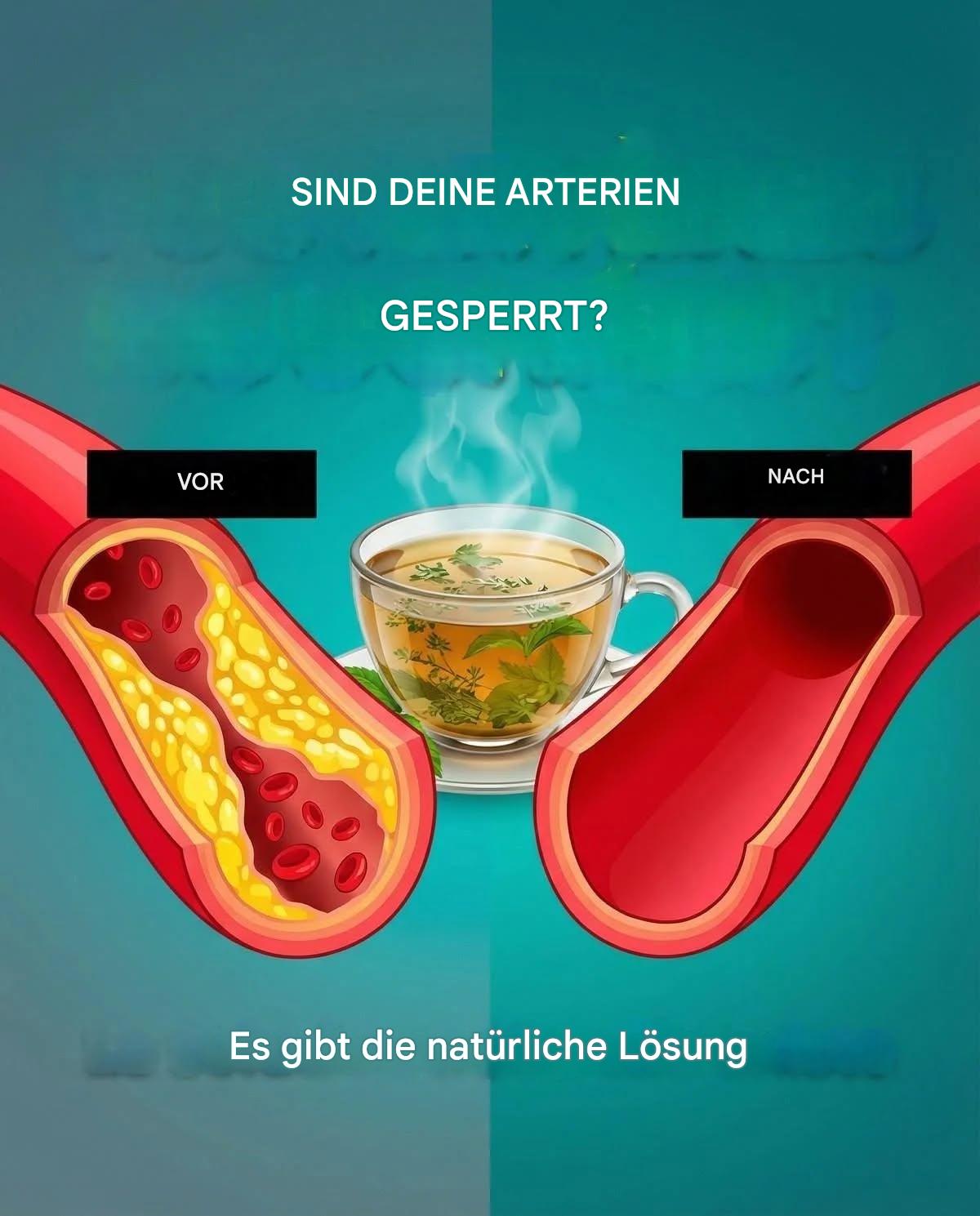 Schon diese 5 Infusionen reinigen Ihre Arterien, normalisieren hohen Blutdruck und beugen Herzinfarkten vor.