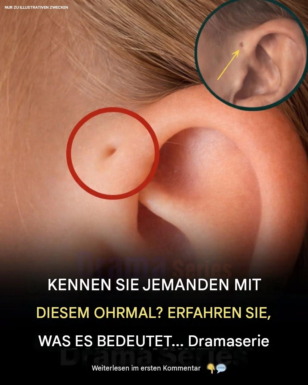 Hast du dieses winzige Loch über deinem Ohr? Die faszinierende Wissenschaft hinter einer seltenen körperlichen Besonderheit.