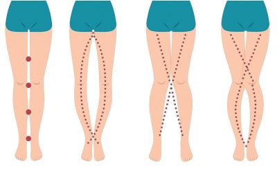 THE LEGS OF A WOMAN CAN SAY AS IT IS THEIR VAGIN….