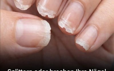 Schwache oder brüchige Nägel: Was Ihr Körper Ihnen damit sagen will